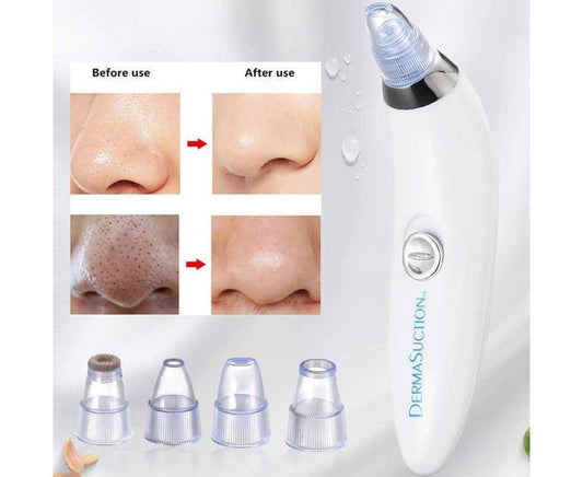 Electric Blackhead Remover Pore Vacuum Suction Face Cleaner Tool